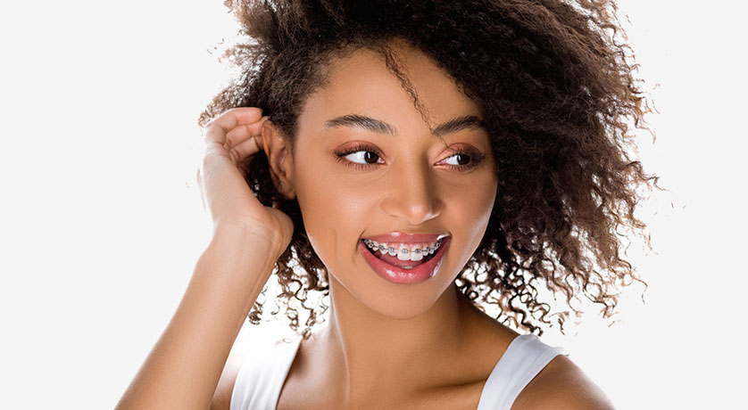 Dental Braces