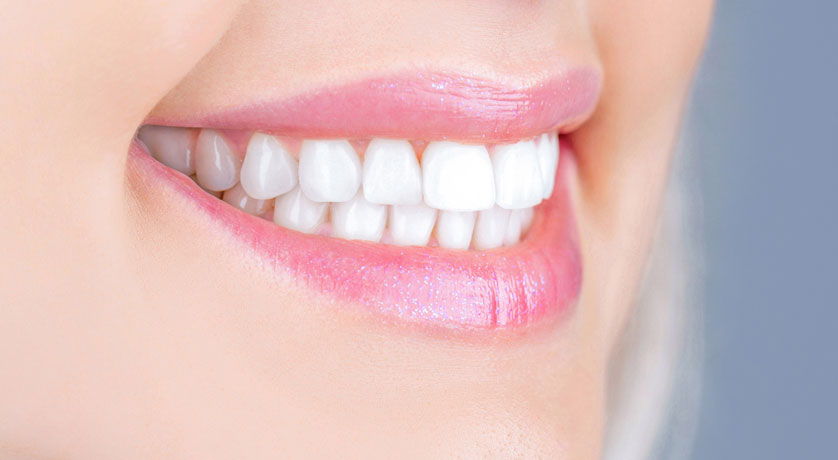 Teeth Whitening
