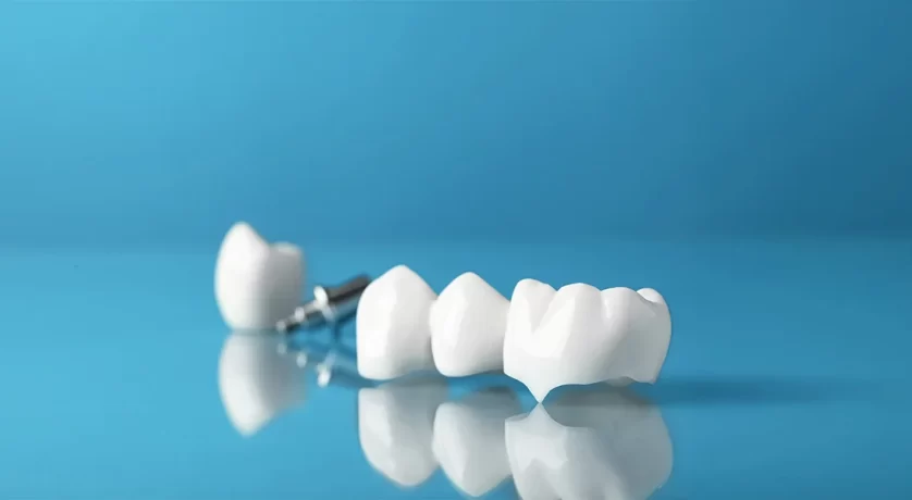 Complete Guide to Dental Crowns: Cost, Procedure & Recovery in Princeton, TX